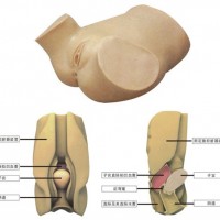 陰道后穹窿穿刺模型